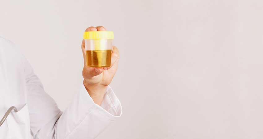 urine colour urine clour